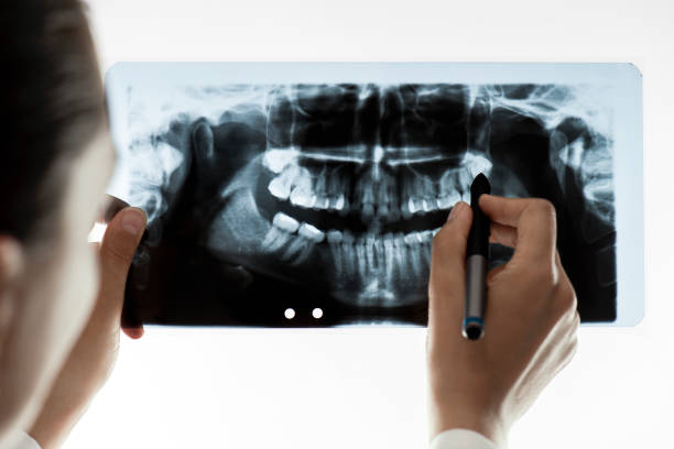 Kelly Family Dentistry’s Panorex X-Ray: Advanced Diagnostics for Your Smile in Huntingburg, IN